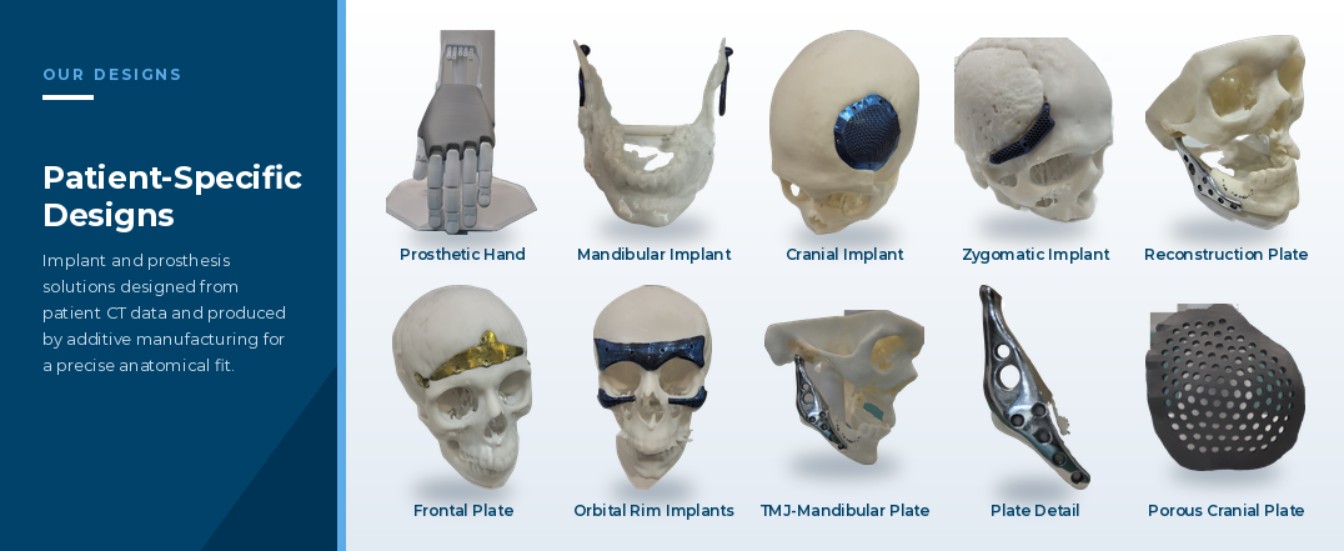 Patient-Specific Implants